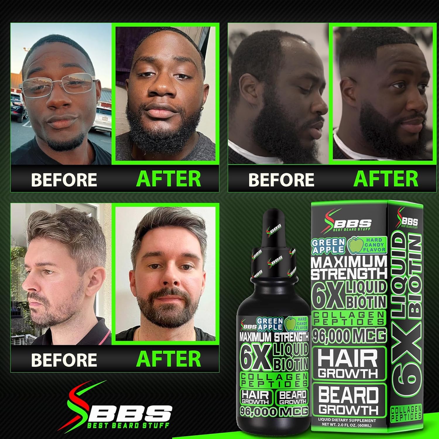 The Ultimate Beard Fuel: Liquid Biotin & Collagen Peptides.