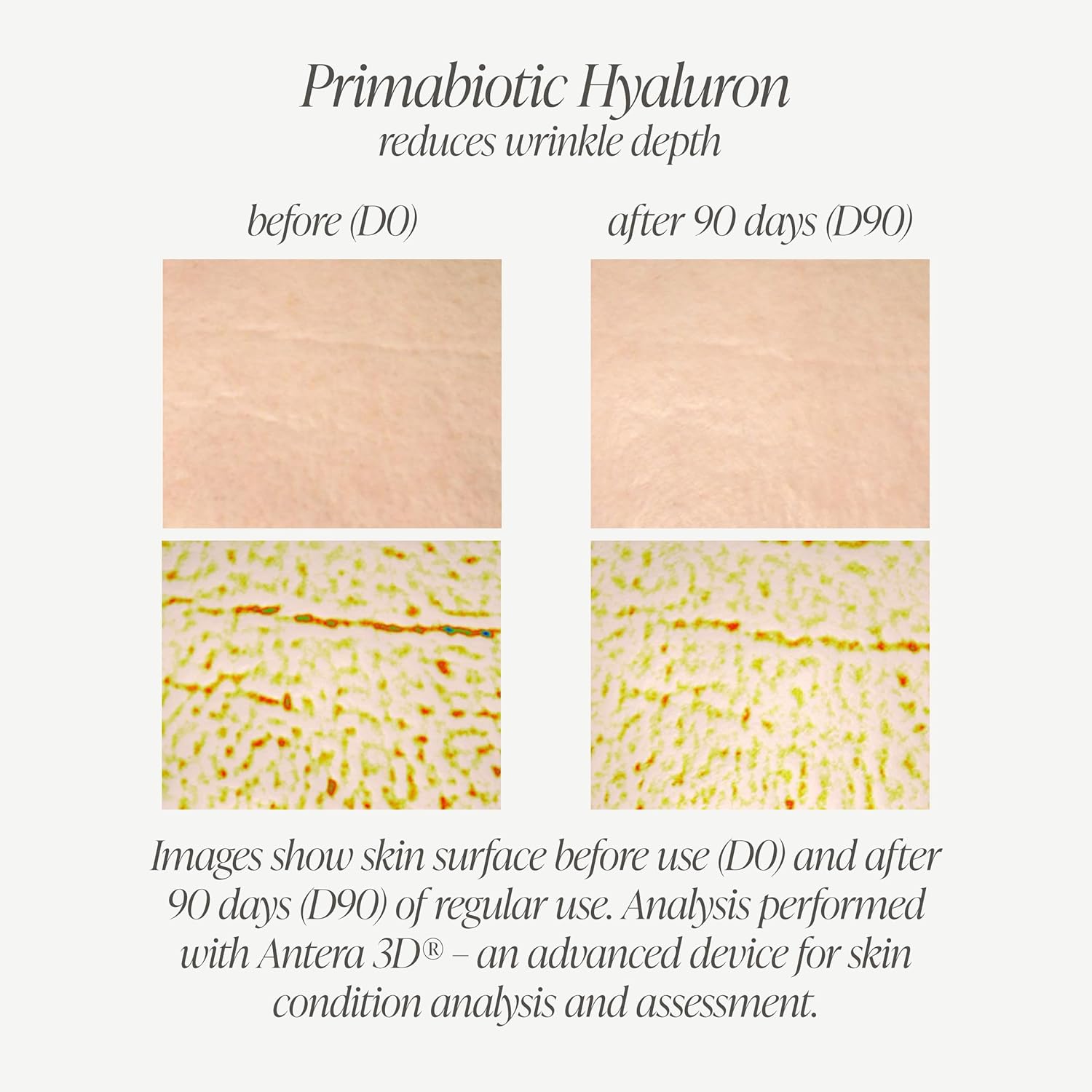 Liquid Radiance: Primabiotic Hyaluronic Acid 250mg Shots (Mango Flavor).